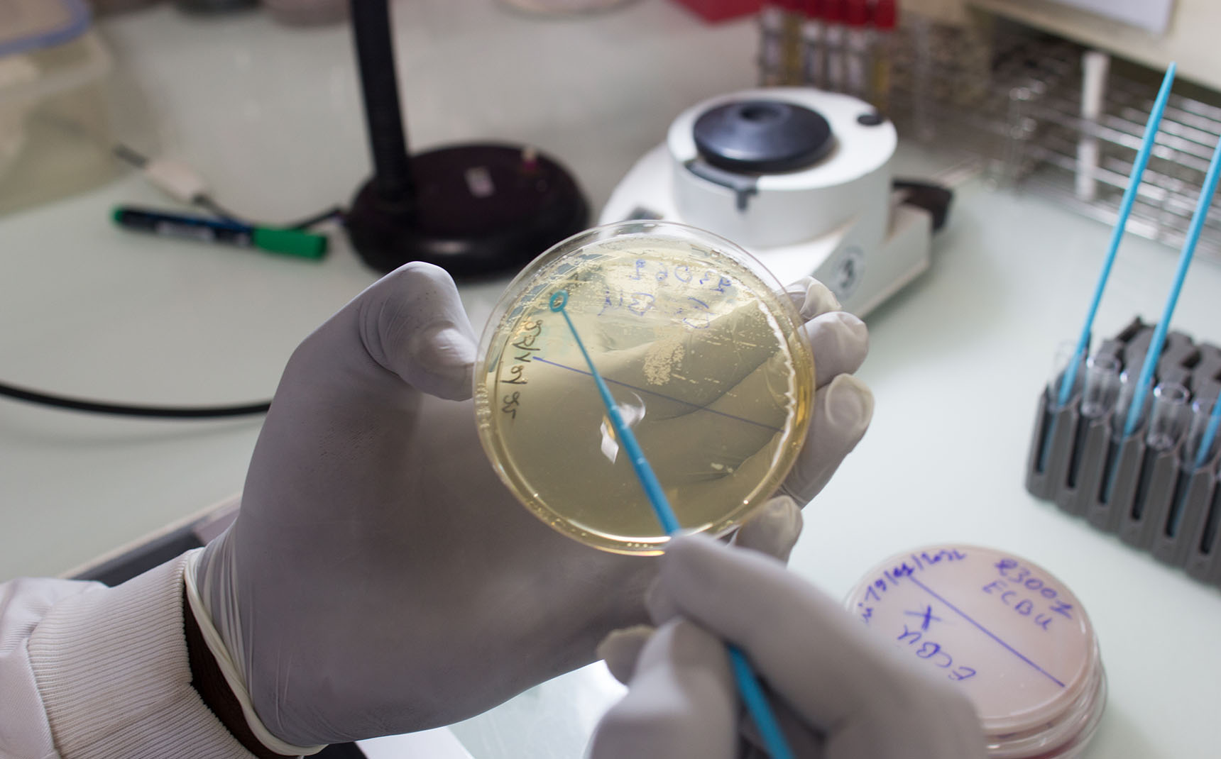 Zoom in on the hands of a lab technician handling a petri dish.