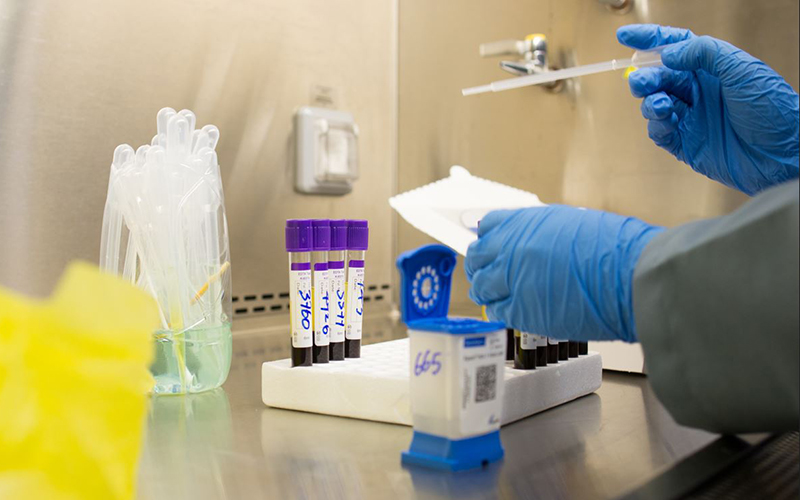 Photo prise en laboratoire avec une pipette et des contenants, à gauche de la photo, deux mains qui tiennent la pipette.